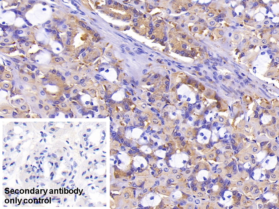 Polyclonal Antibody to PDZ And LIM Domain Protein 1 (PDLIM1)