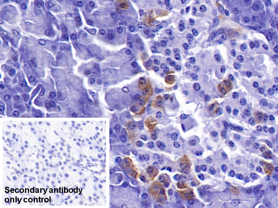 Polyclonal Antibody to PDZ And LIM Domain Protein 1 (PDLIM1)