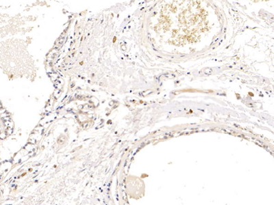 Polyclonal Antibody to Prolactin Induced Protein (PIP)