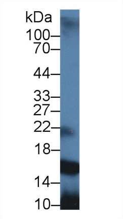 Polyclonal Antibody to Prolactin Induced Protein (PIP)