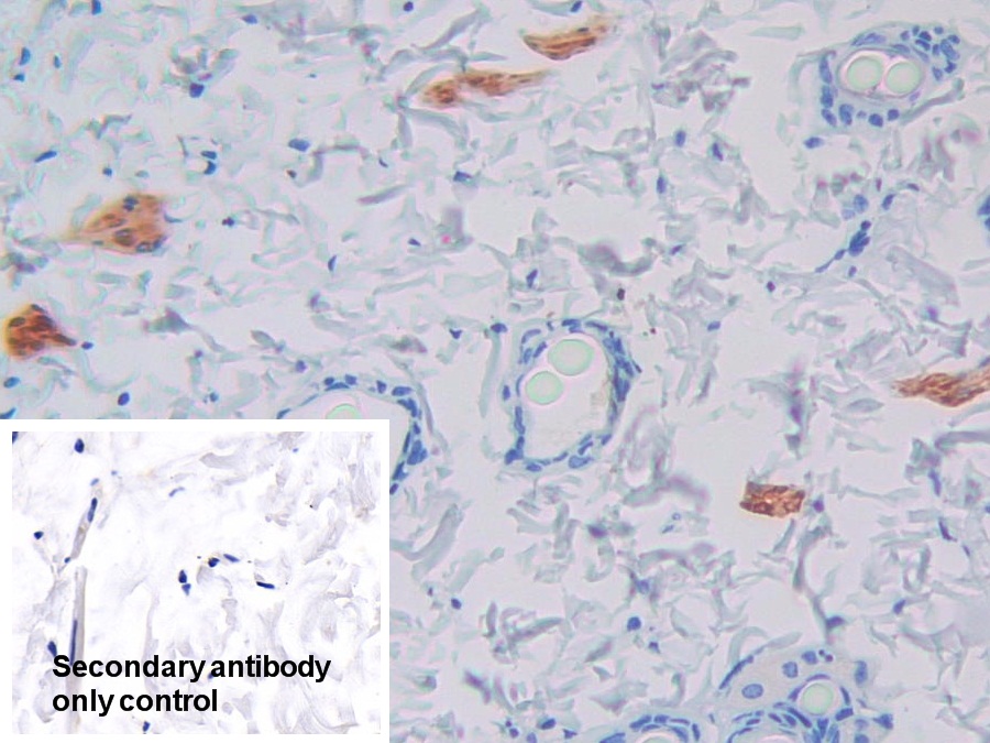 Polyclonal Antibody to Prolactin Induced Protein (PIP)