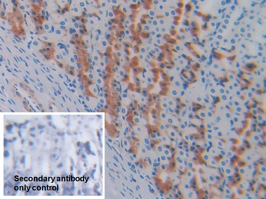 Polyclonal Antibody to Prolactin Induced Protein (PIP)