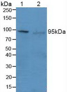 Polyclonal Antibody to PR Domain Containing Protein 1 (PRDM1)