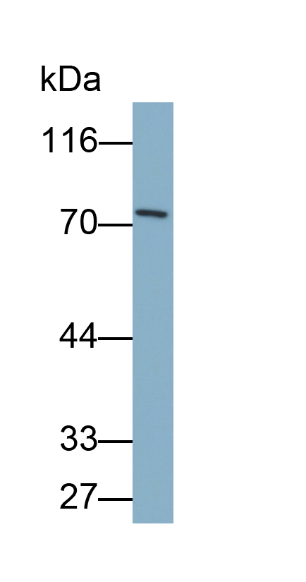 Polyclonal Antibody to PR Domain Containing Protein 1 (PRDM1)