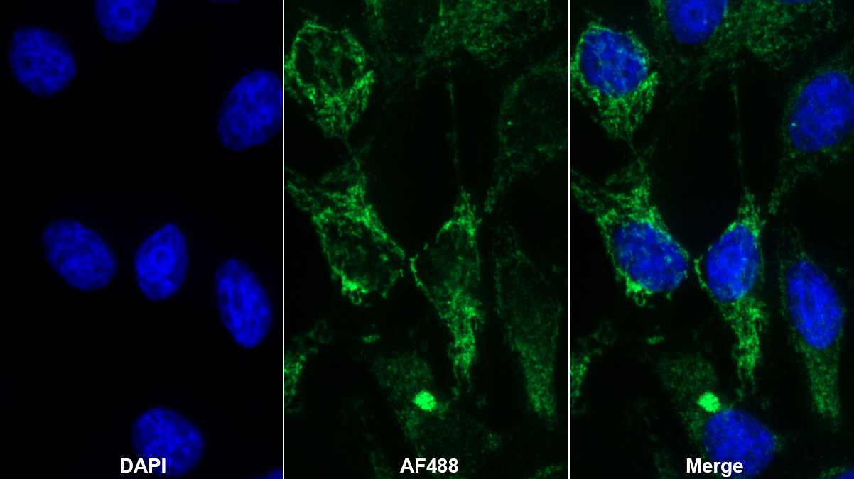 Polyclonal Antibody to Peroxidasin Homolog (PXDN)