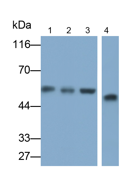 Polyclonal Antibody to Pygopus Homolog 1 (PYGO1)