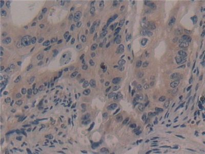 Polyclonal Antibody to Ribosomal Protein S6 Kinase Alpha 1 (RPS6Ka1)