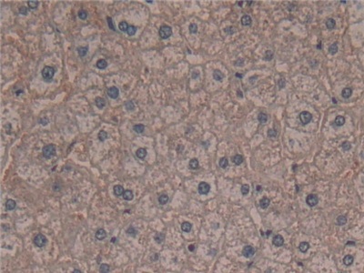 Polyclonal Antibody to Ribosomal Protein S6 Kinase Alpha 1 (RPS6Ka1)