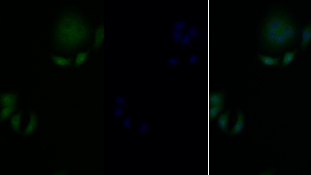 Polyclonal Antibody to Ribosomal Protein S6 Kinase Beta 2 (RPS6Kb2)