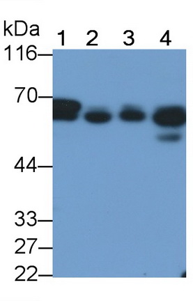 Polyclonal Antibody to Ribosomal Protein S6 Kinase Beta 2 (RPS6Kb2)