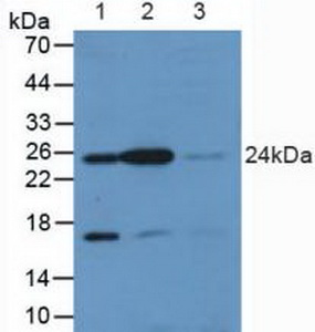 Polyclonal Antibody to V-Ral Simian Leukemia Viral Oncogene Homolog A (RALA)