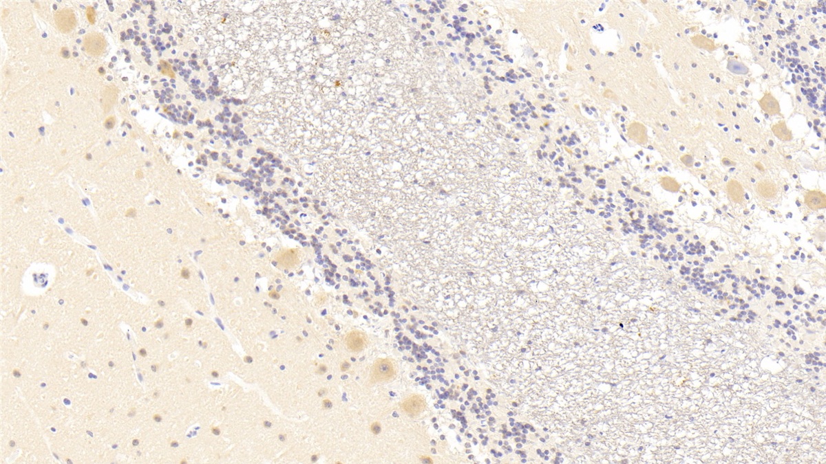 Polyclonal Antibody to RCC1 And BTB Domain Containing Protein 2 (RCBTB2)