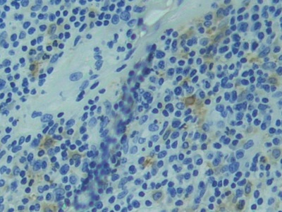 Polyclonal Antibody to Related To Receptor Tyrosine Kinase (RYK)