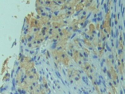 Polyclonal Antibody to Related To Receptor Tyrosine Kinase (RYK)