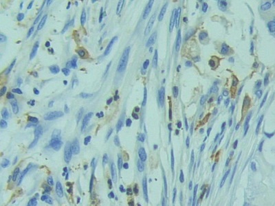 Polyclonal Antibody to Related To Receptor Tyrosine Kinase (RYK)