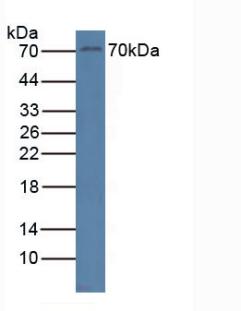 Polyclonal Antibody to Related To Receptor Tyrosine Kinase (RYK)