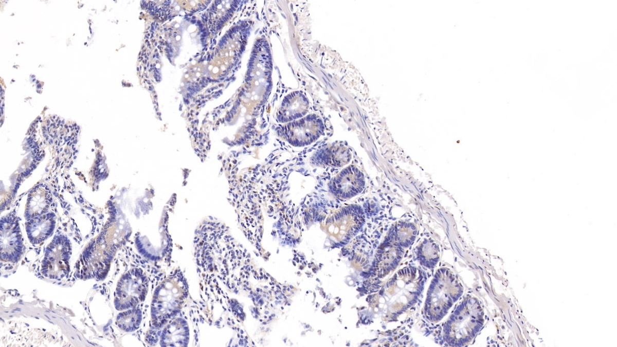 Polyclonal Antibody to R-Spondin 1 (RSPO1)