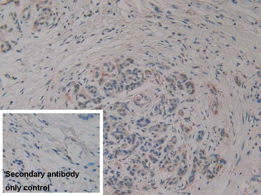 Polyclonal Antibody to R-Spondin 3 (RSPO3)