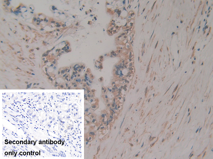 Polyclonal Antibody to R-Spondin 3 (RSPO3)