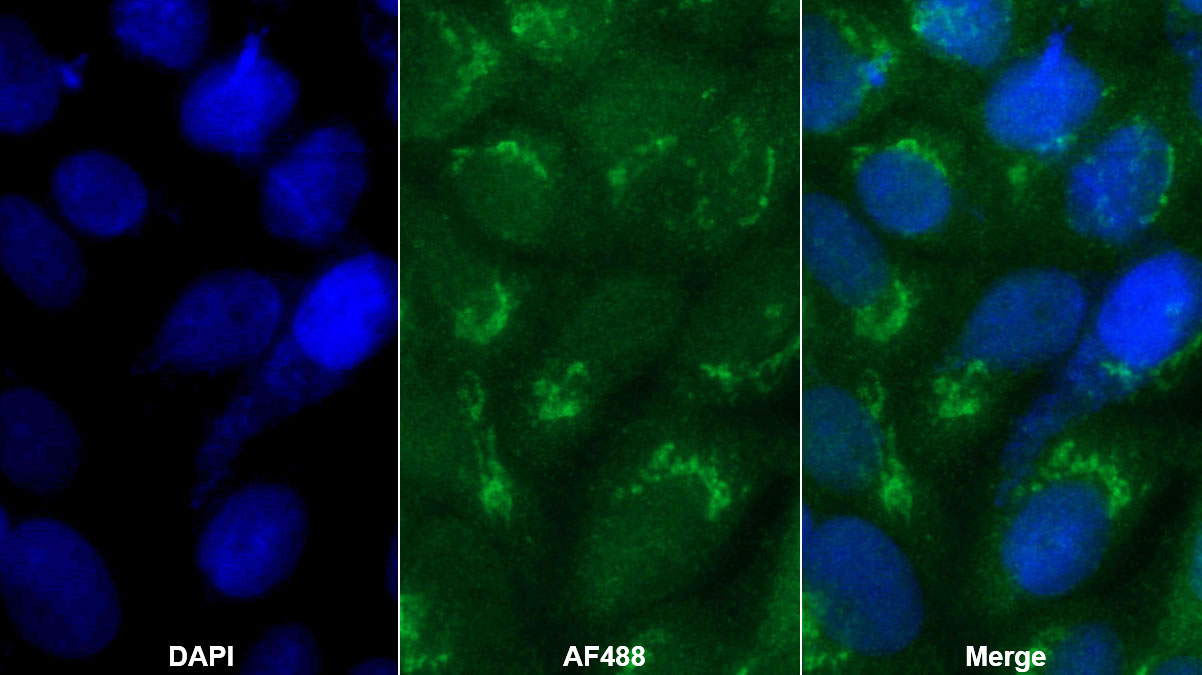 Polyclonal Antibody to Salt Inducible Kinase 2 (SIK2)