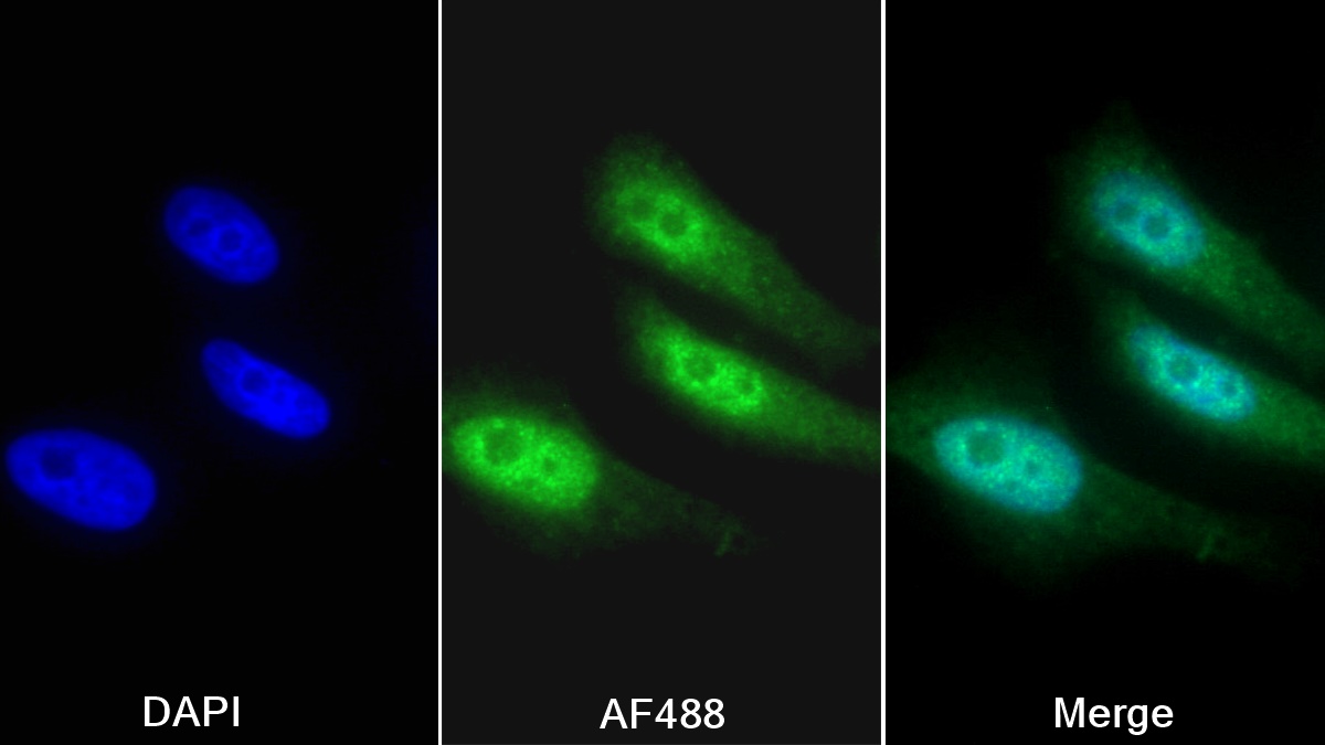 Polyclonal Antibody to TERF1 Interacting Nuclear Factor 2 (TINF2)