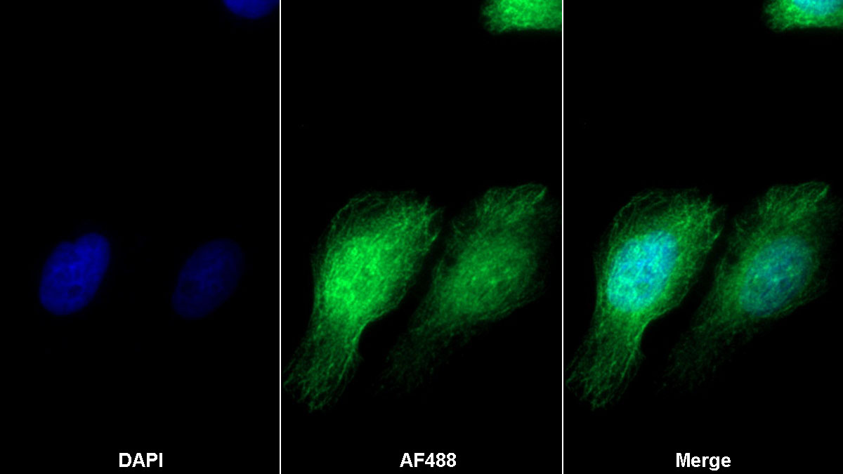 Polyclonal Antibody to TNFRSF1A Associated Via Death Domain Protein (TRADD)