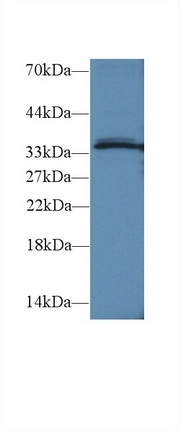 Polyclonal Antibody to TNFRSF1A Associated Via Death Domain Protein (TRADD)