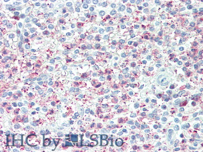 Polyclonal Antibody to Tumor Necrosis Factor Alpha Induced Protein 6 (TNFaIP6)