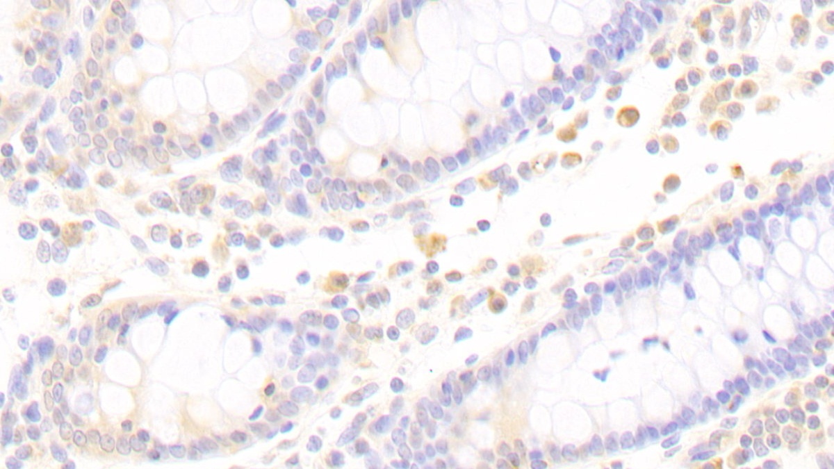 Polyclonal Antibody to Amyloid Beta Precursor Protein Binding B1 Interacting Protein (APBB1IP)