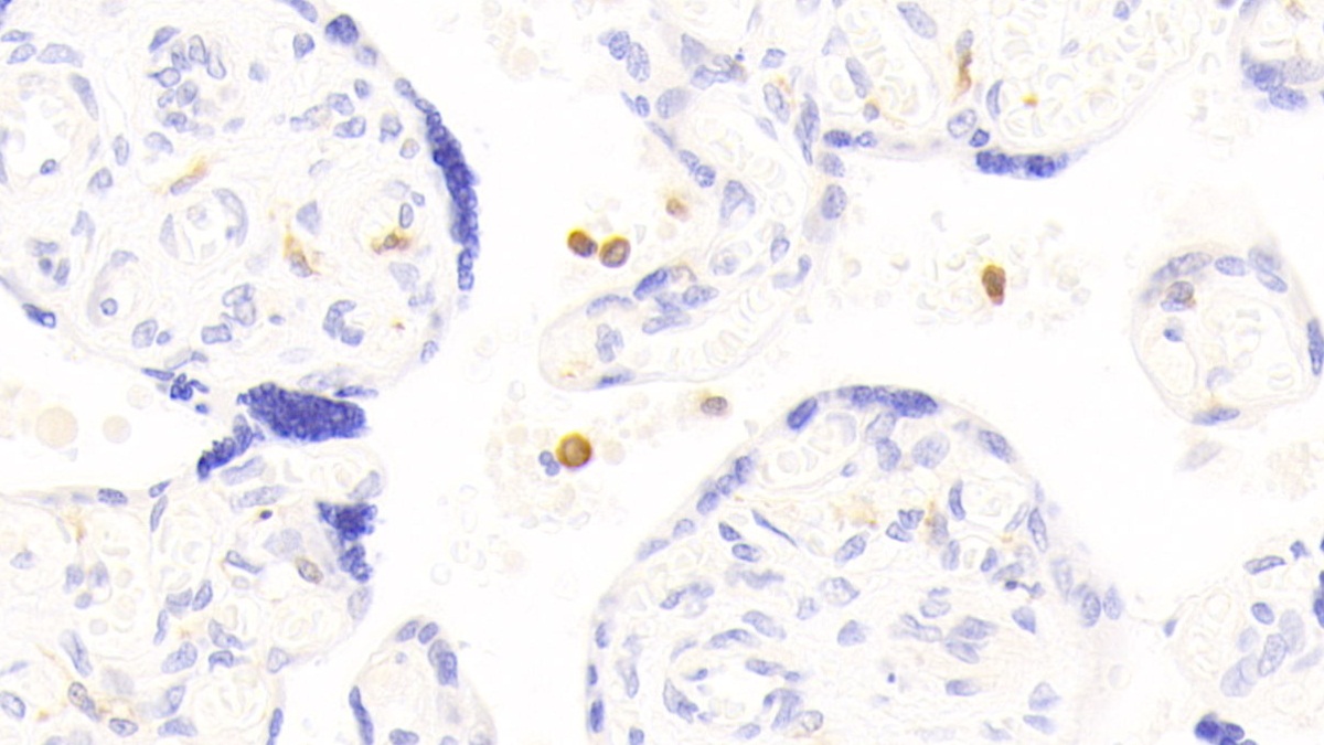 Polyclonal Antibody to Amyloid Beta Precursor Protein Binding B1 Interacting Protein (APBB1IP)