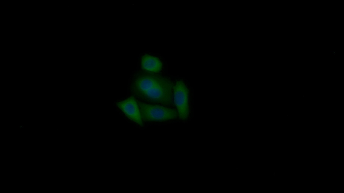 Polyclonal Antibody to HAUS Augmin Like Complex Subunit 7 (HAUS7)