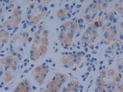 Polyclonal Antibody to Metastasis Associated In Colon Cancer 1 (MACC1)