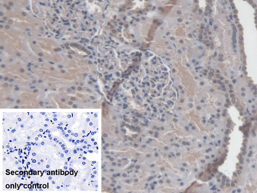 Polyclonal Antibody to RAB37, Member RAS Oncogene Family (RAB37)