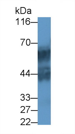 Polyclonal Antibody to Keratin 71 (KRT71)