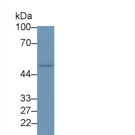 Polyclonal Antibody to Suppressor Of Variegation 4-20 Homolog 2 (SUV420H2)