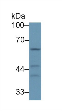 Polyclonal Antibody to Transmembrane Protein 173 (TMEM173)