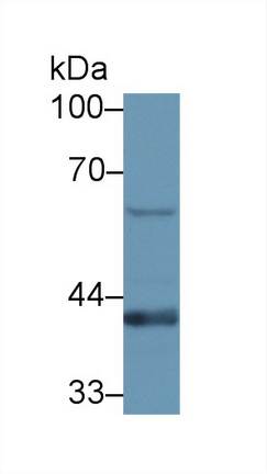 Polyclonal Antibody to Transmembrane Protein 173 (TMEM173)