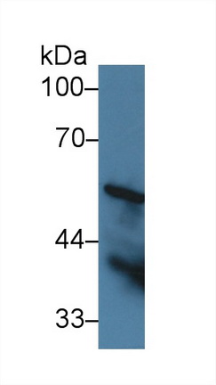 Polyclonal Antibody to Transmembrane Protein 173 (TMEM173)