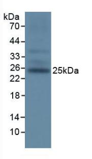 Polyclonal Antibody to T-Cell Immunoreceptor With Ig And ITIM Domains Protein (TIGIT)