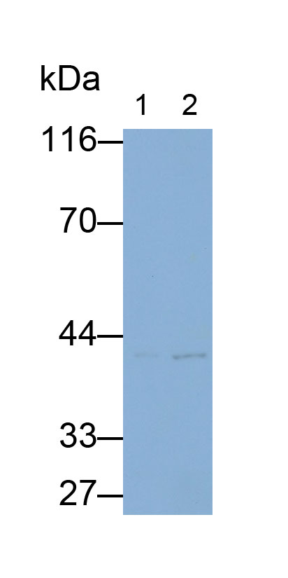 Polyclonal Antibody to Hepatocellular Carcinoma Related Protein 1 (HCRP1)