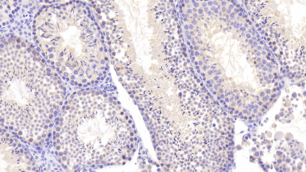 Polyclonal Antibody to Nei Endonuclease VIII Like Protein 3 (NEIL3)