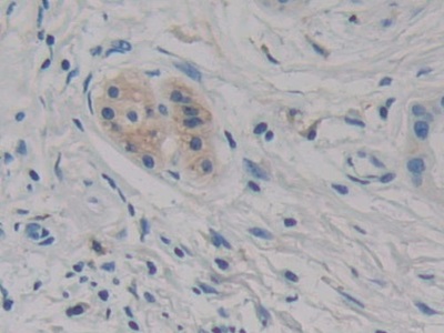 Polyclonal Antibody to Cell Death Inducing DFFA Like Effector C (CIDEC)