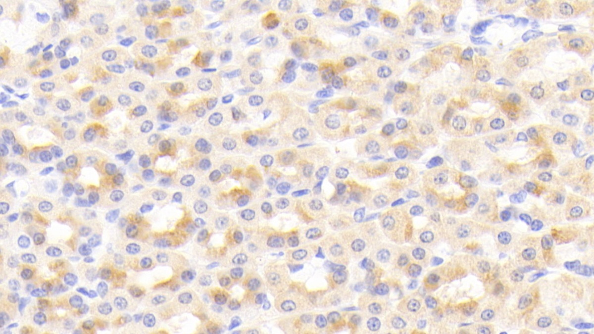 Polyclonal Antibody to Cell Death Inducing DFFA Like Effector C (CIDEC)