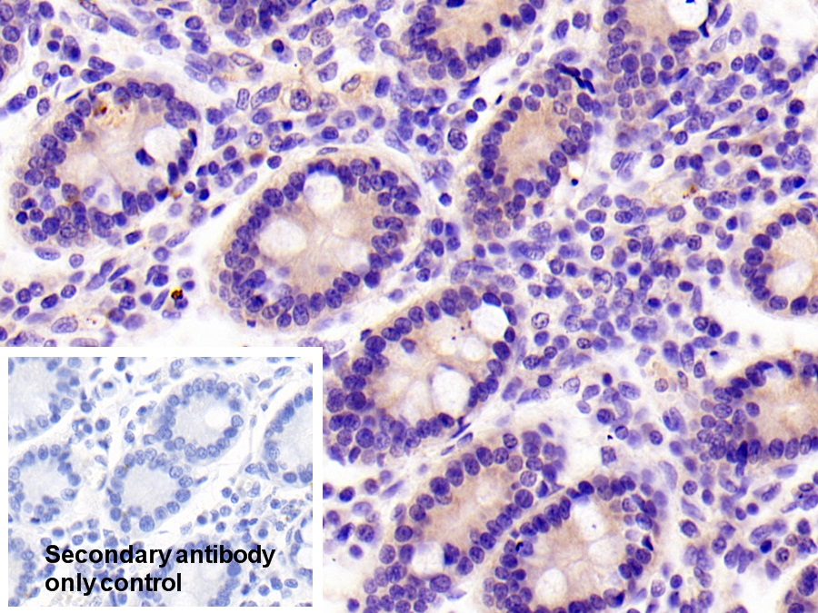 Polyclonal Antibody to Non Metastatic Cells 6, Protein Expressed In (NME6)