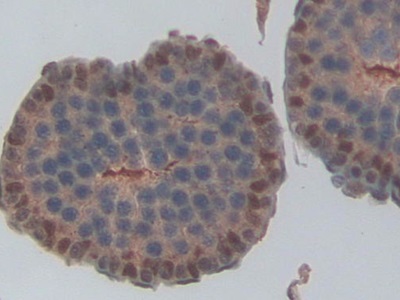 Polyclonal Antibody to Non Metastatic Cells 6, Protein Expressed In (NME6)