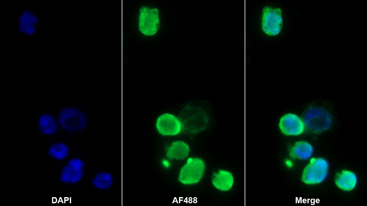 Polyclonal Antibody to Fibronectin Type III Domain Containing Protein 5 (FNDC5)