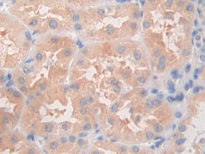 Polyclonal Antibody to Angiopoietin Like Protein 5 (ANGPTL5)