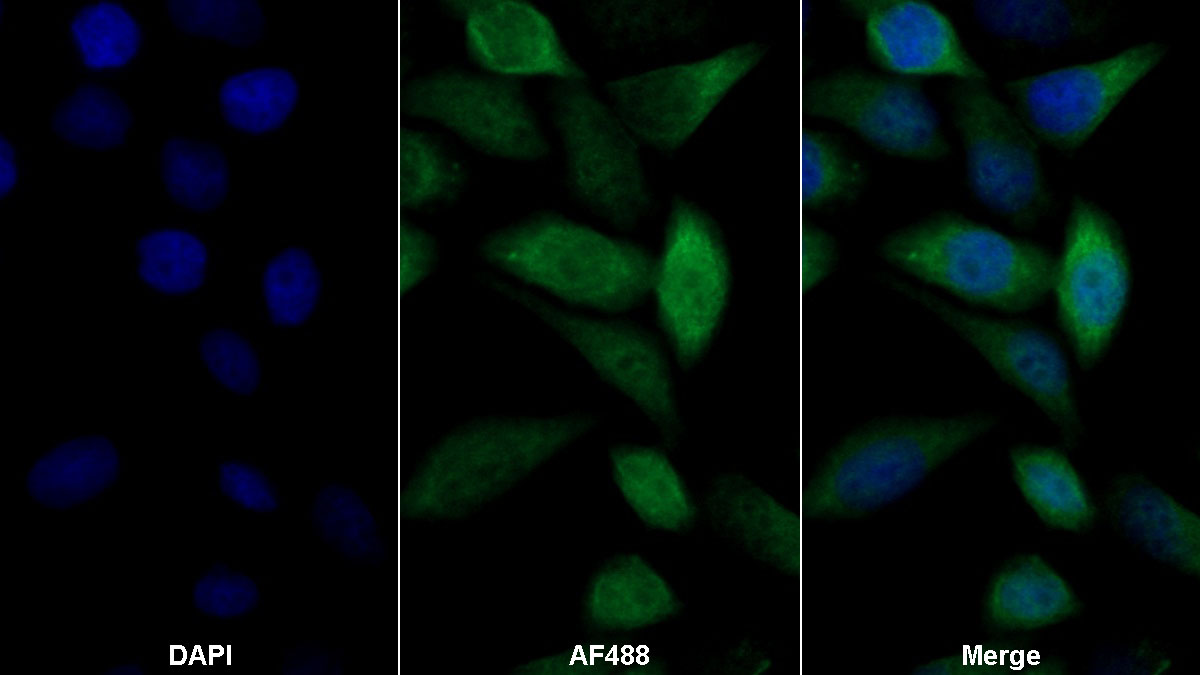 Polyclonal Antibody to GRB2 Associated Binding Protein 3 (GAB3)