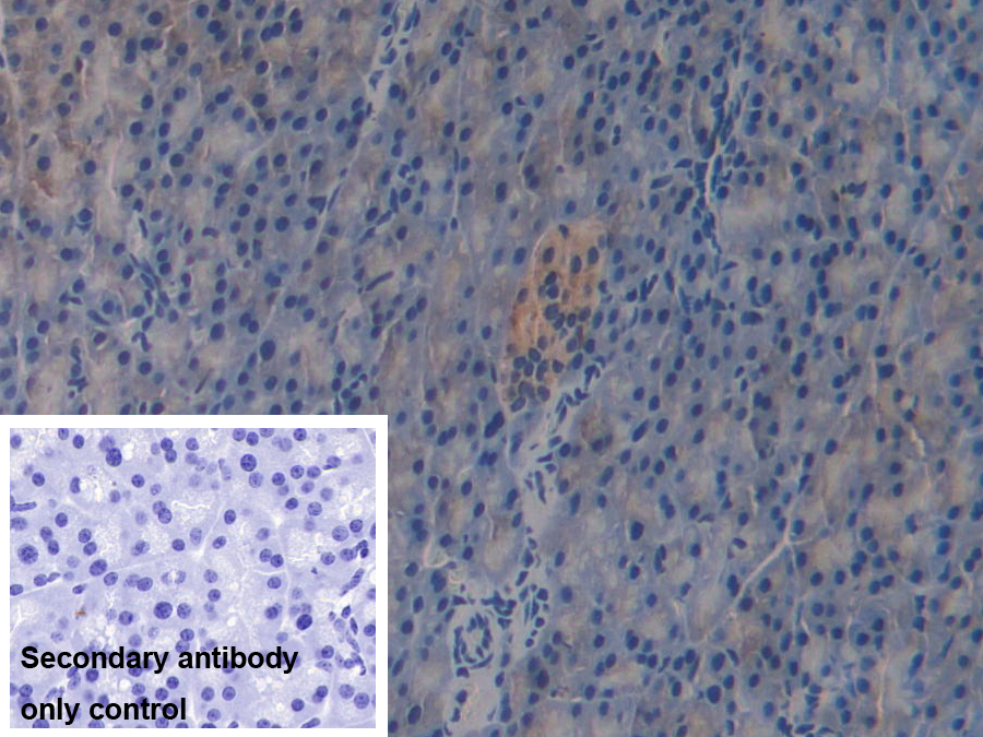 Polyclonal Antibody to GRB2 Associated Binding Protein 3 (GAB3)