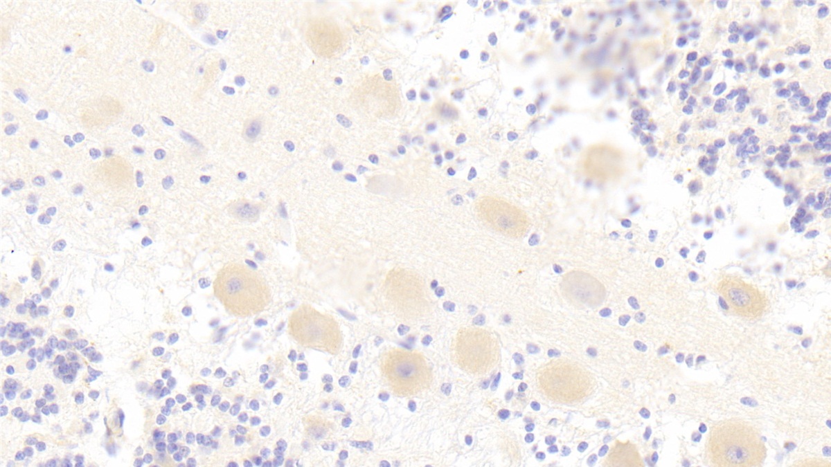 Polyclonal Antibody to Toll Interleukin 1 Receptor Domain Containing Adaptor Protein (TIRAP)